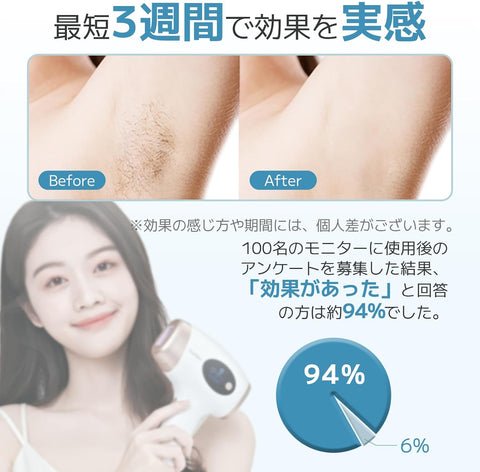 月額1,980円レンタルプラン：Sarlisi IPL光脱毛器 AI01 ホワイト – GYMGATE